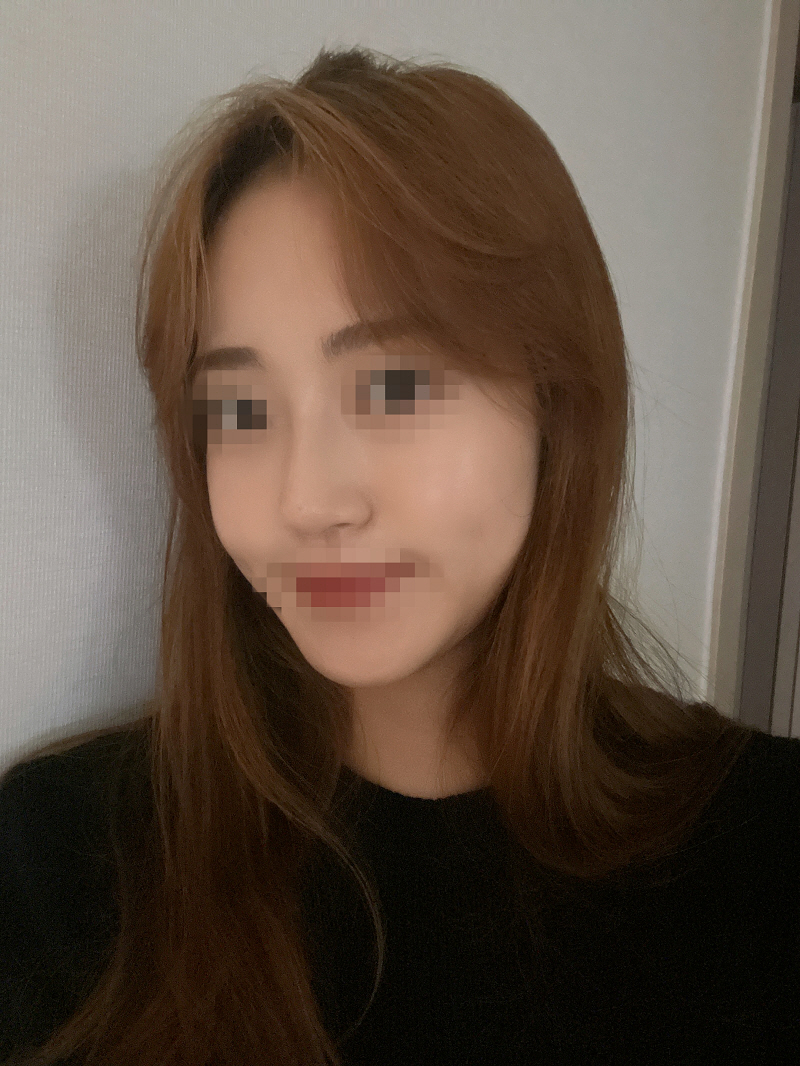 수술후기이미지