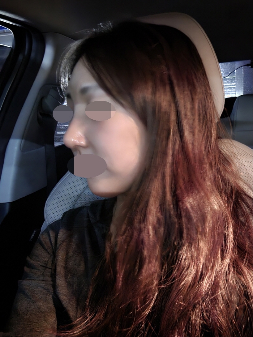 수술후기이미지