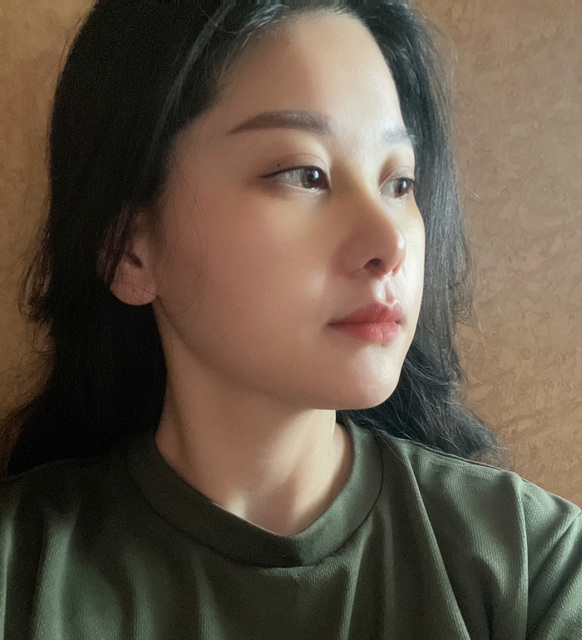 수술후기이미지