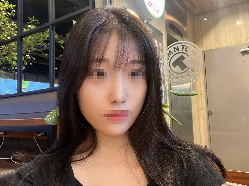 수술후기이미지