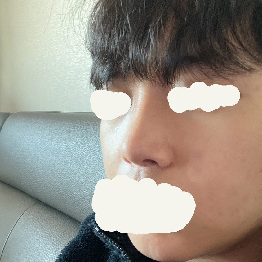 수술후기이미지