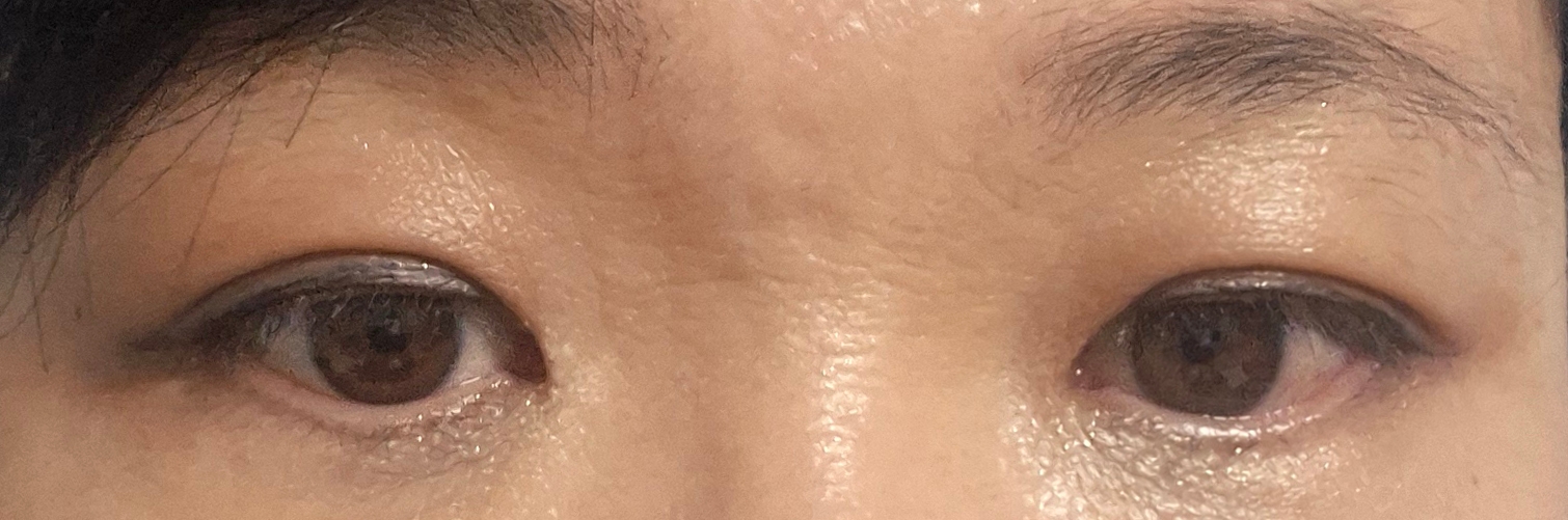 수술후기이미지