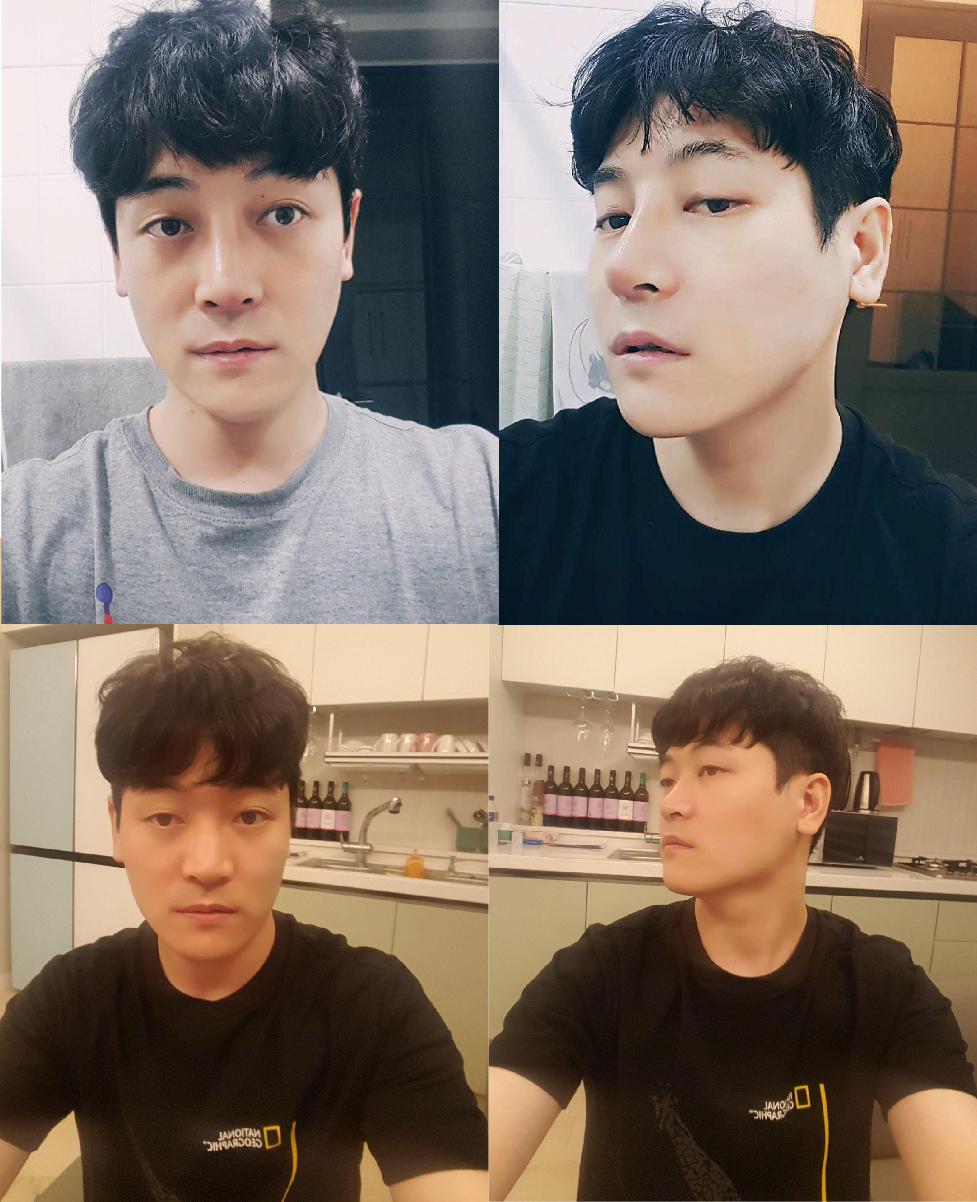 수술후기이미지