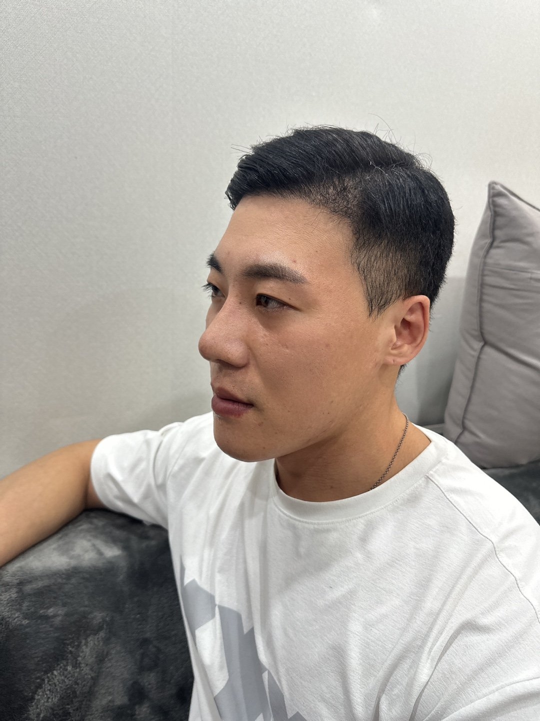 수술후기이미지