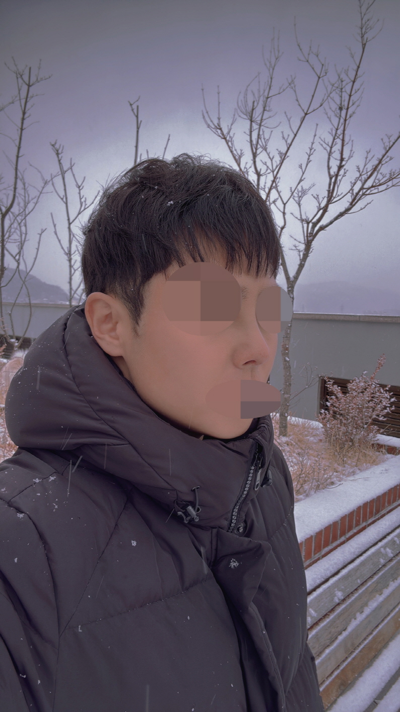 수술후기이미지