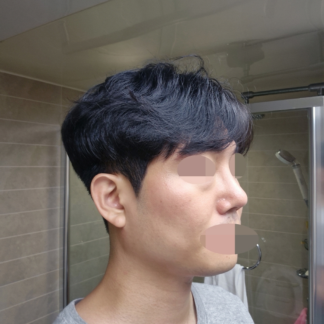 수술후기이미지