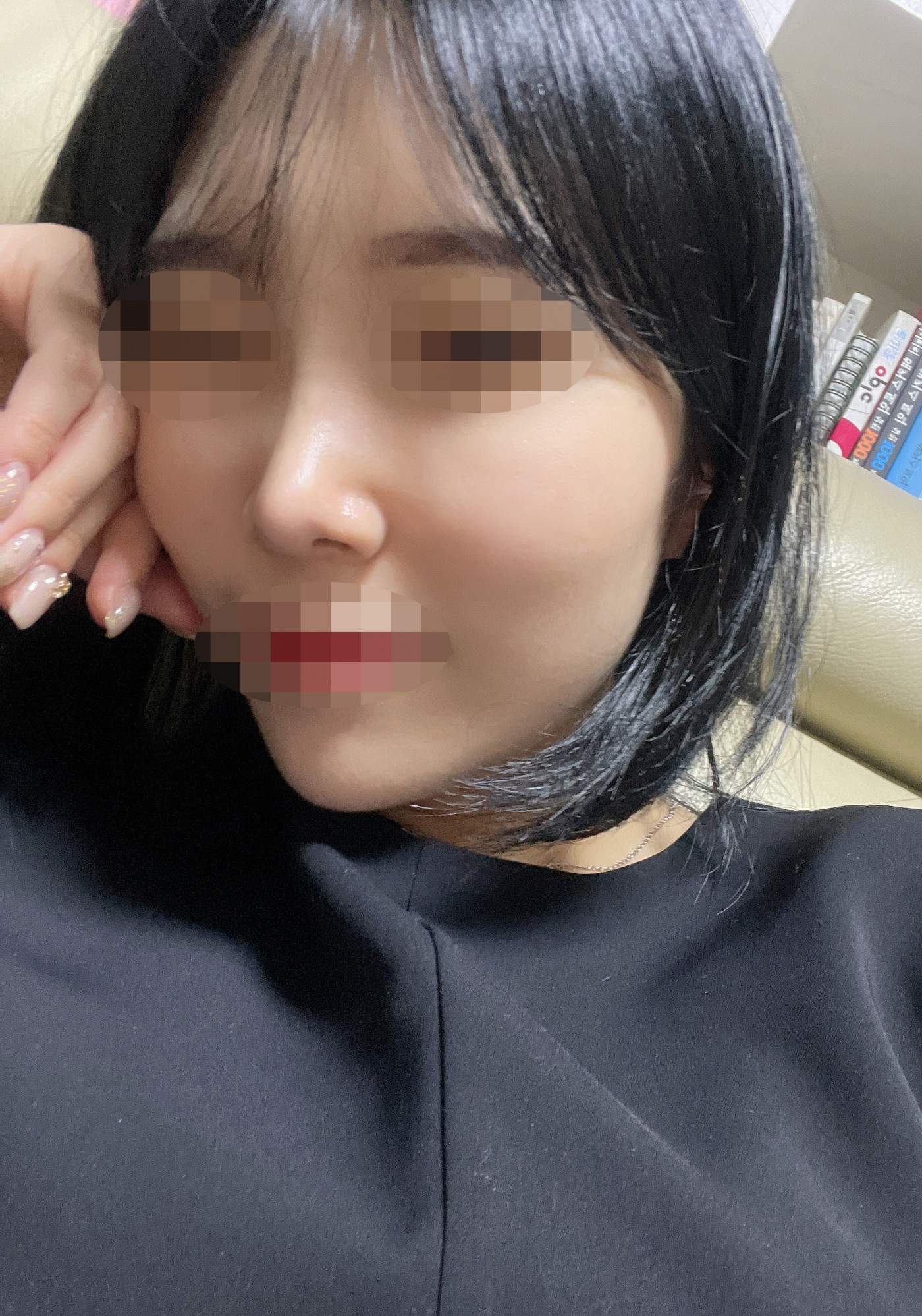 수술후기이미지