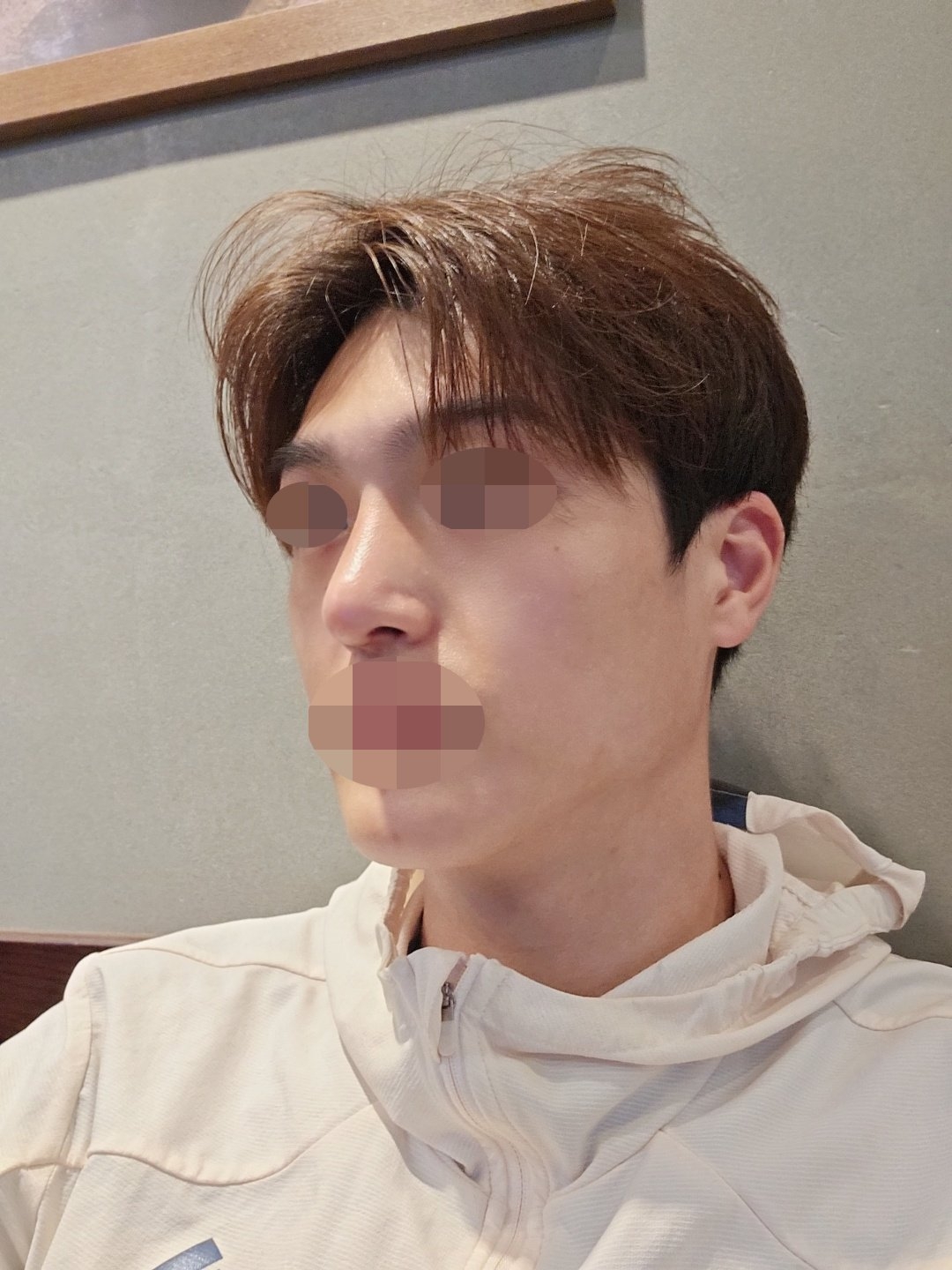 수술후기이미지