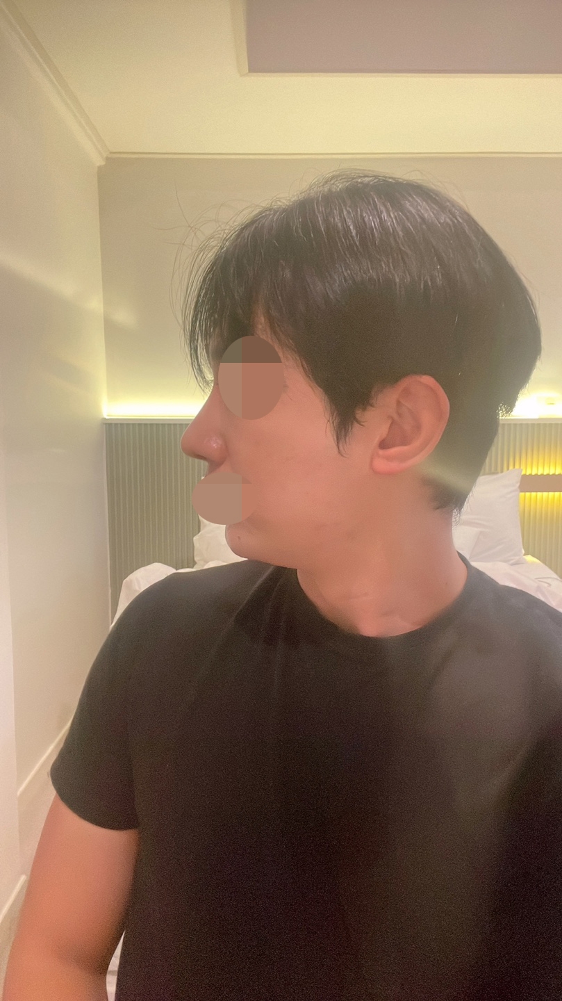 수술후기이미지