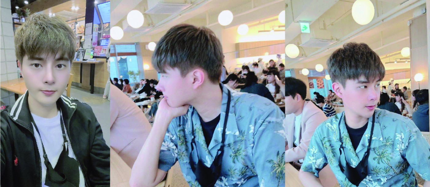 수술후기이미지