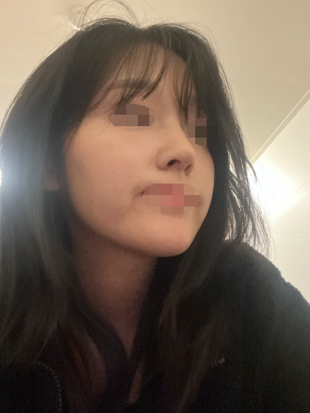 수술후기이미지