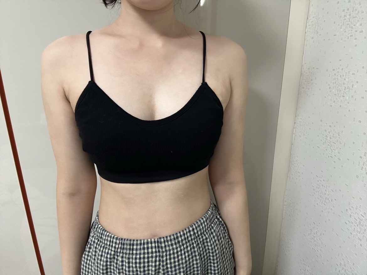 수술후기이미지