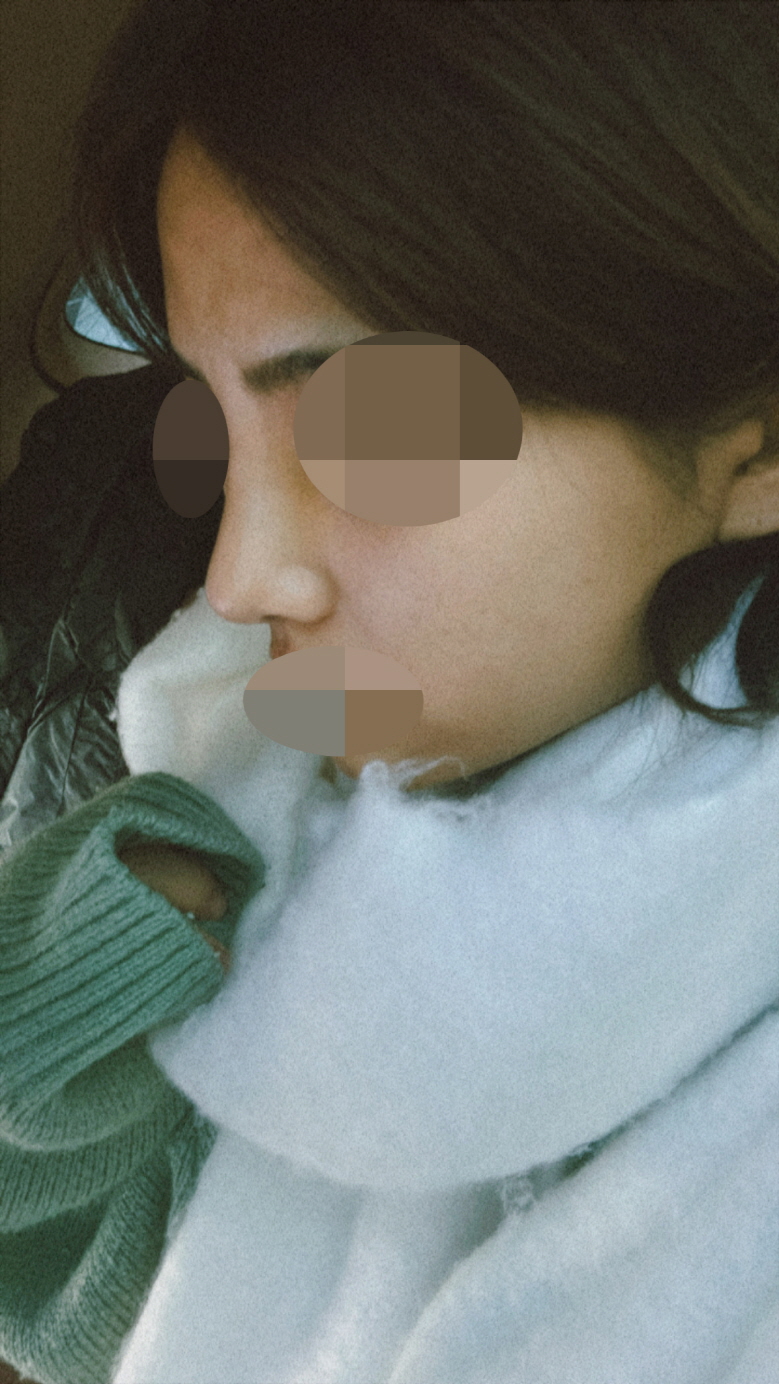 수술후기이미지