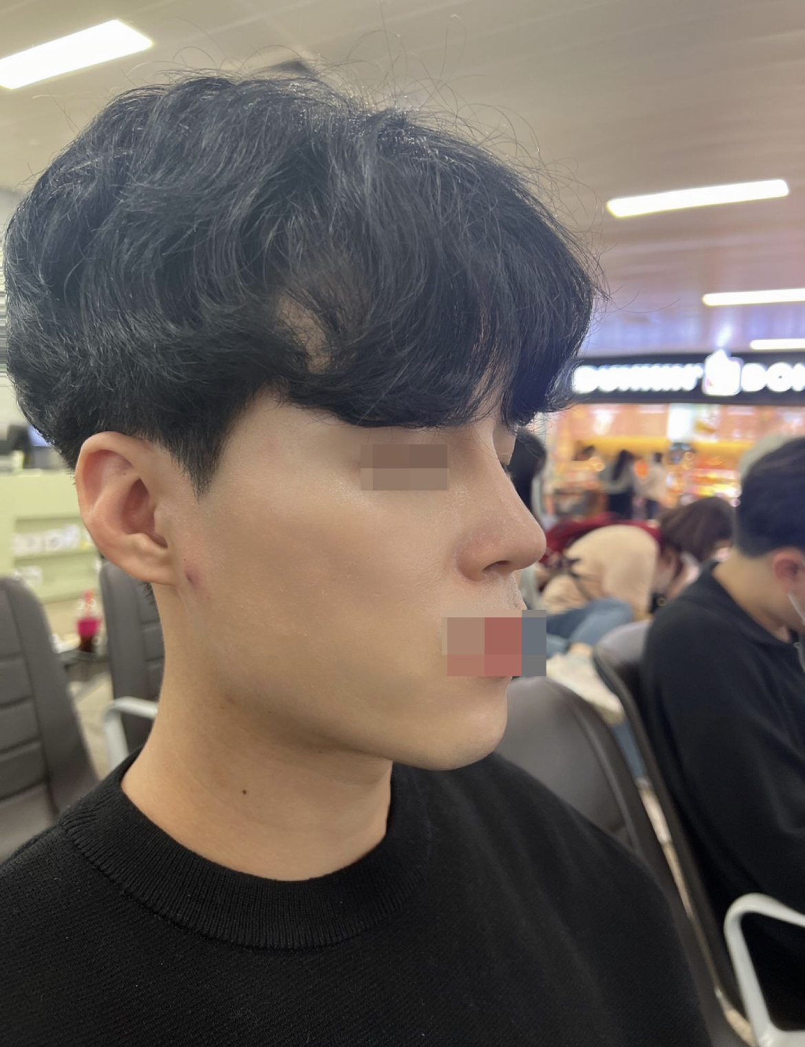 수술후기이미지