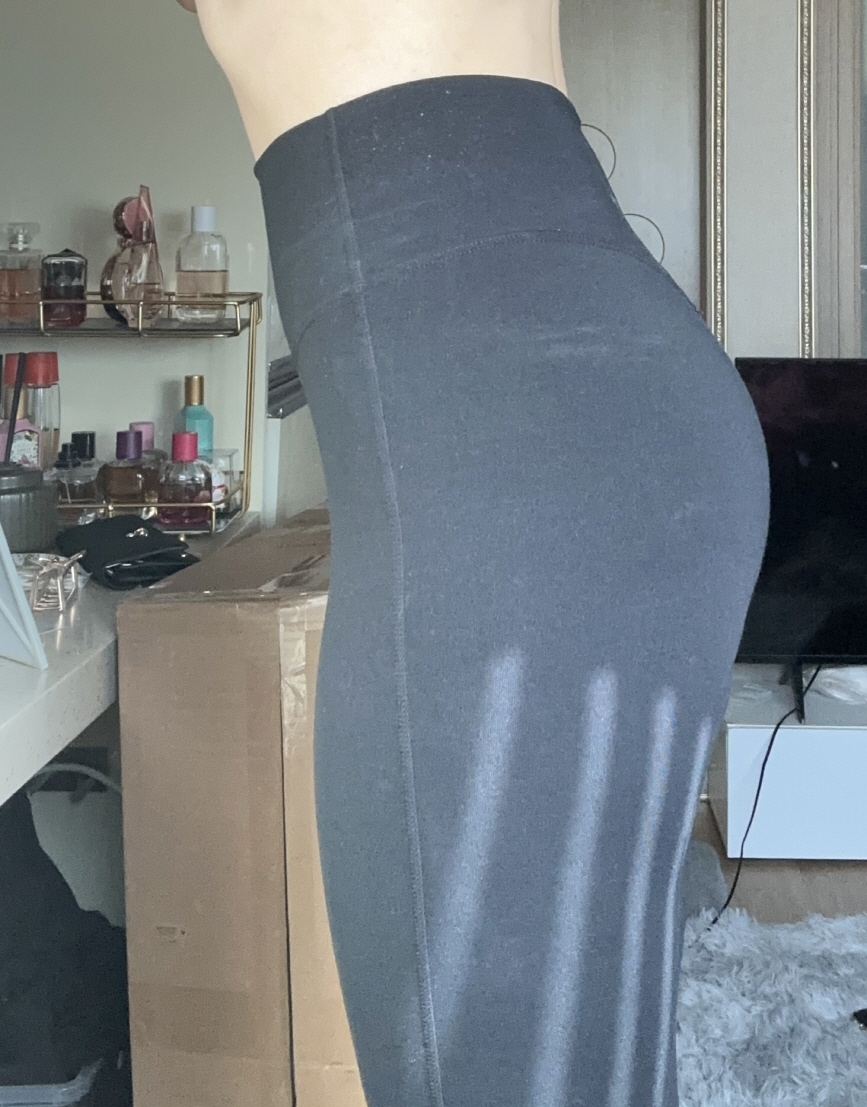 수술후기이미지