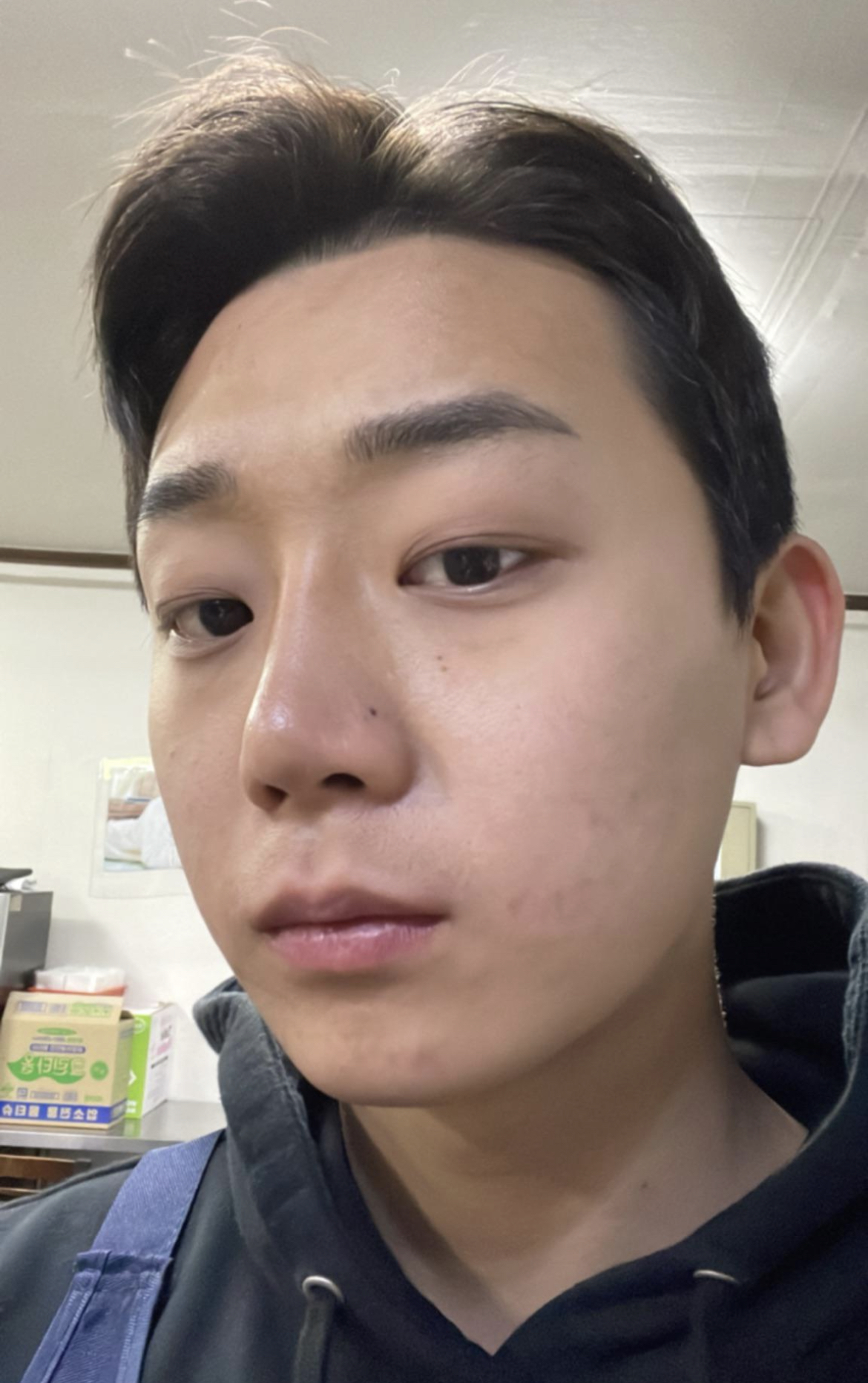 수술후기이미지