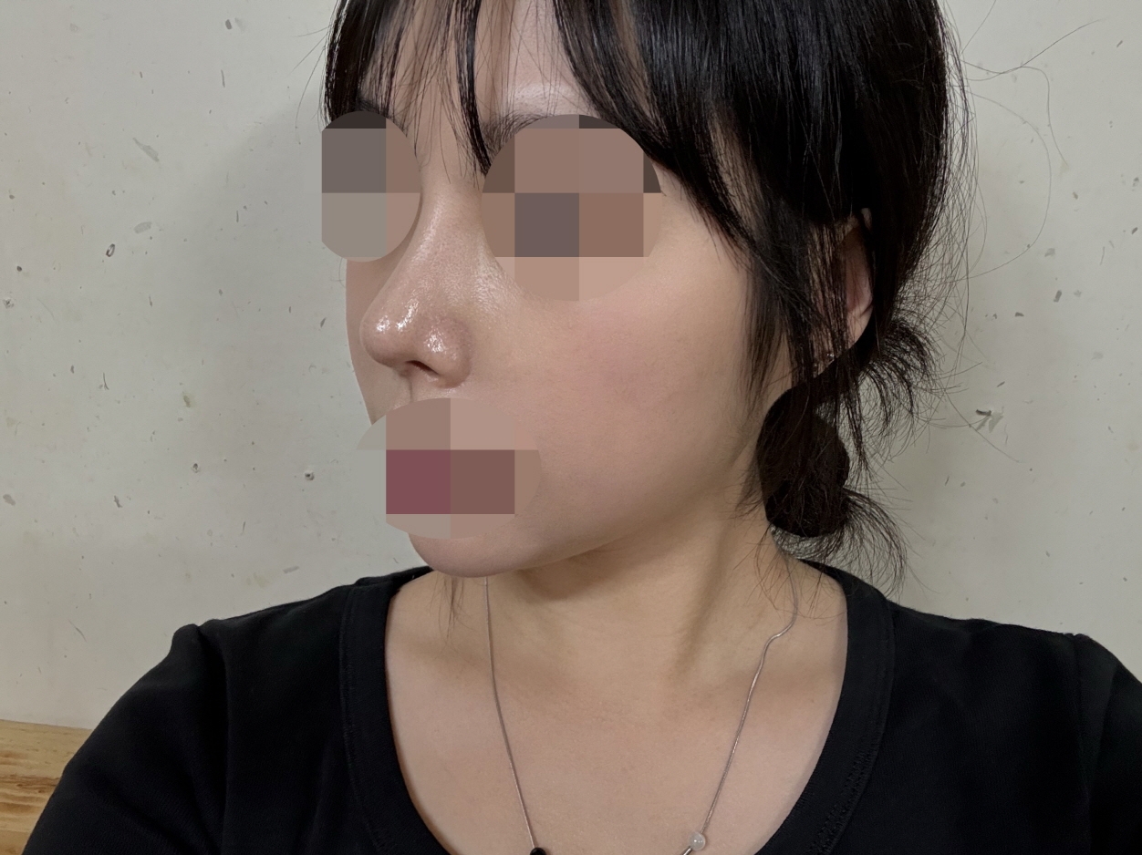 수술후기이미지