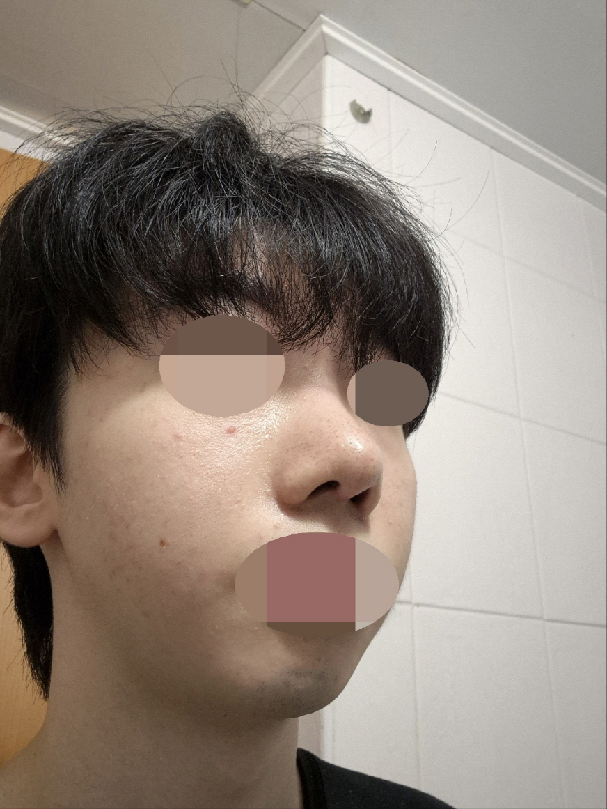 수술후기이미지