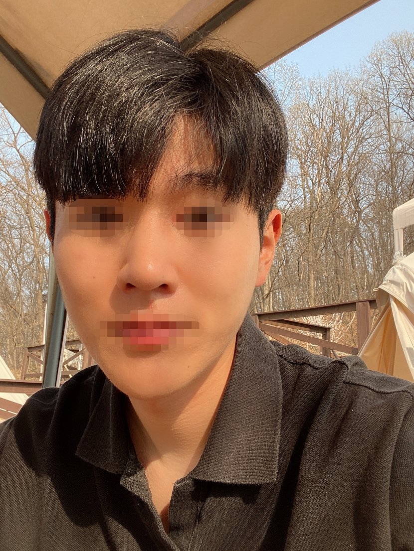 수술후기이미지