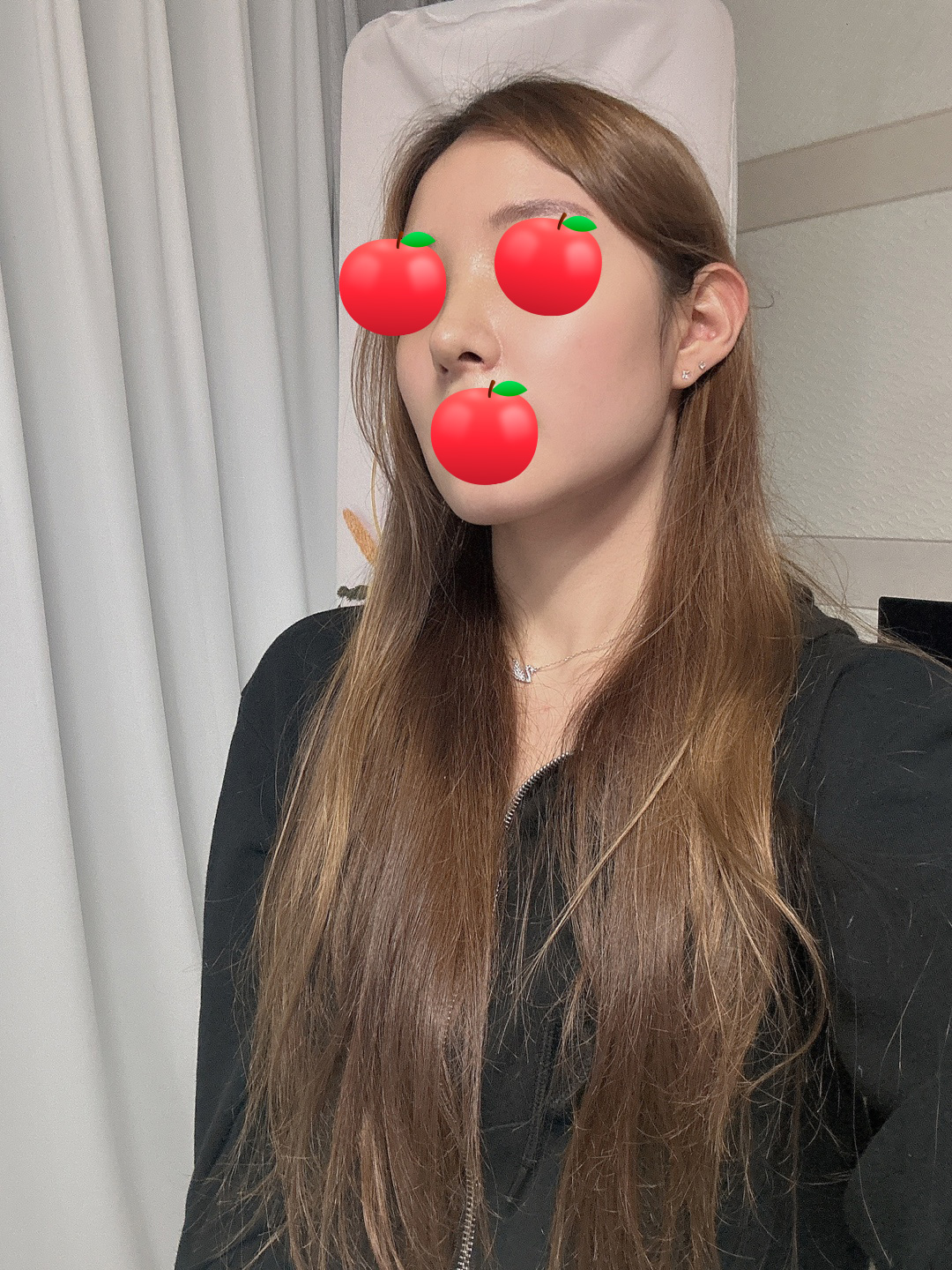 수술후기이미지