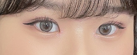 수술후기이미지