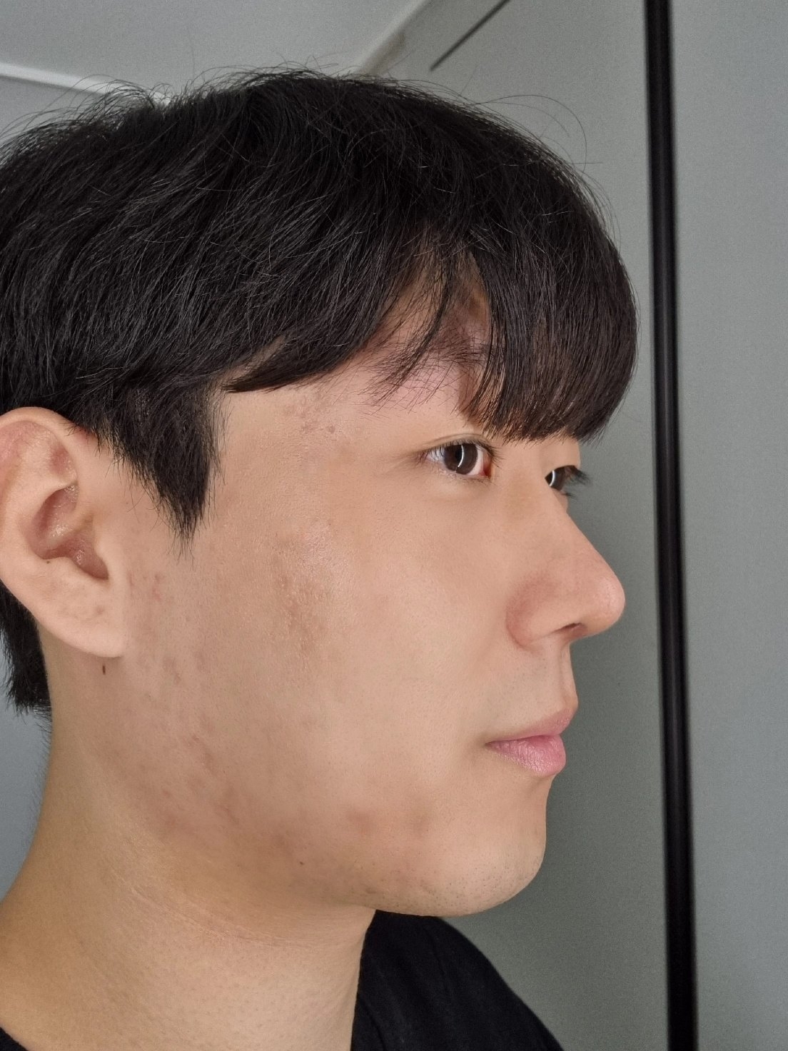 수술후기이미지