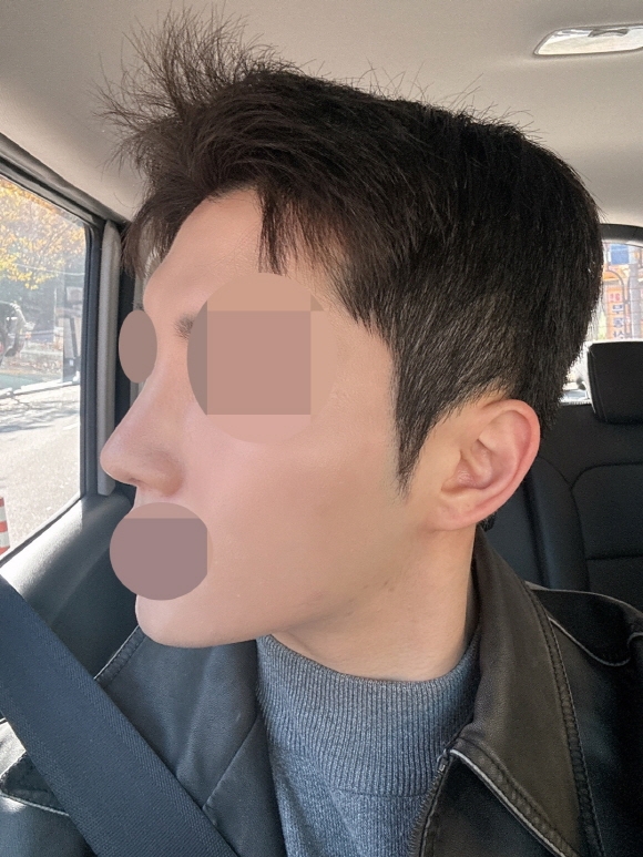 수술후기이미지