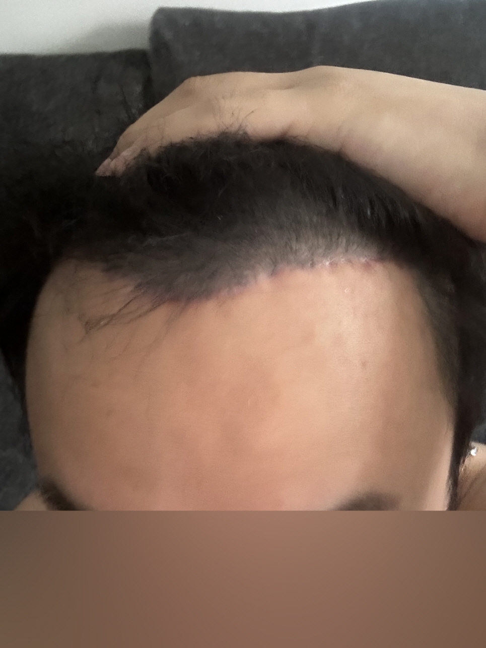 수술후기이미지