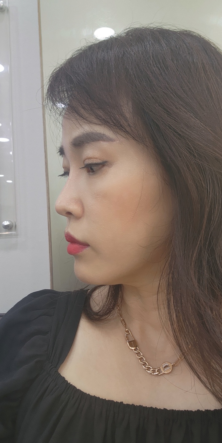 수술후기이미지