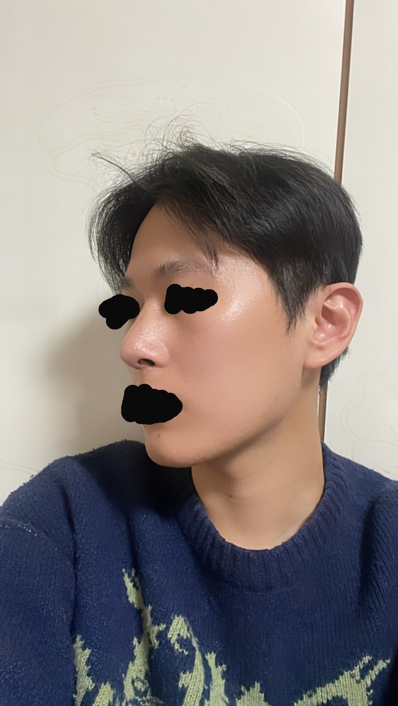 수술후기이미지