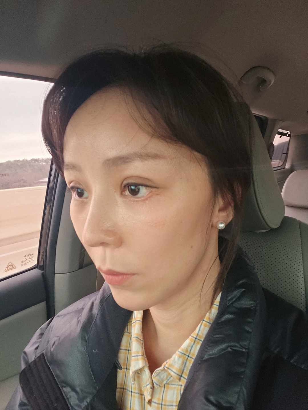 수술후기이미지