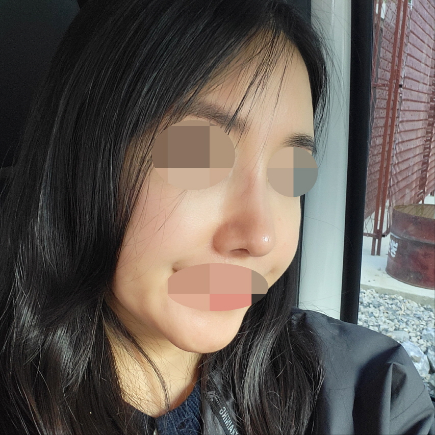 수술후기이미지