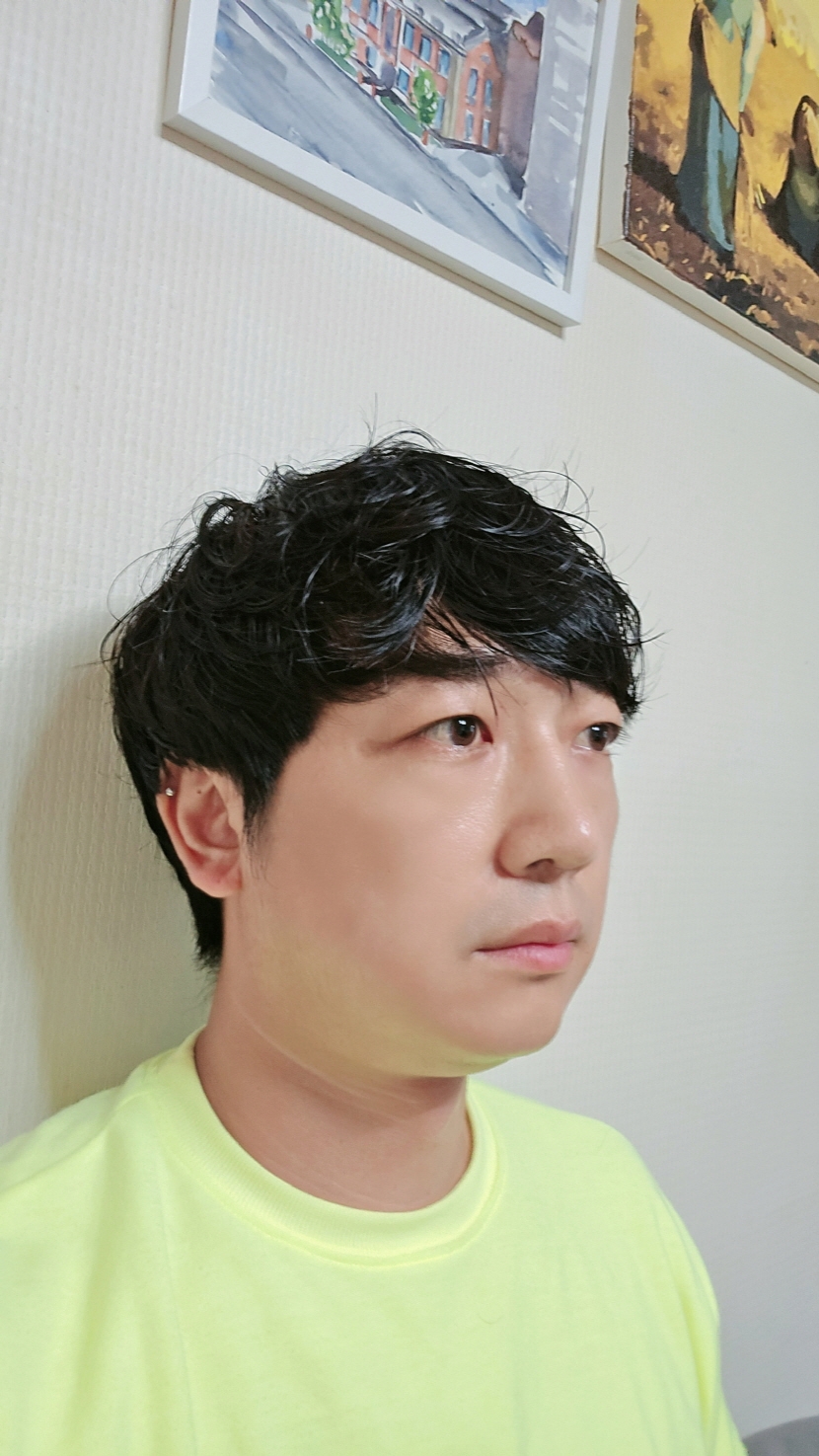 수술후기이미지