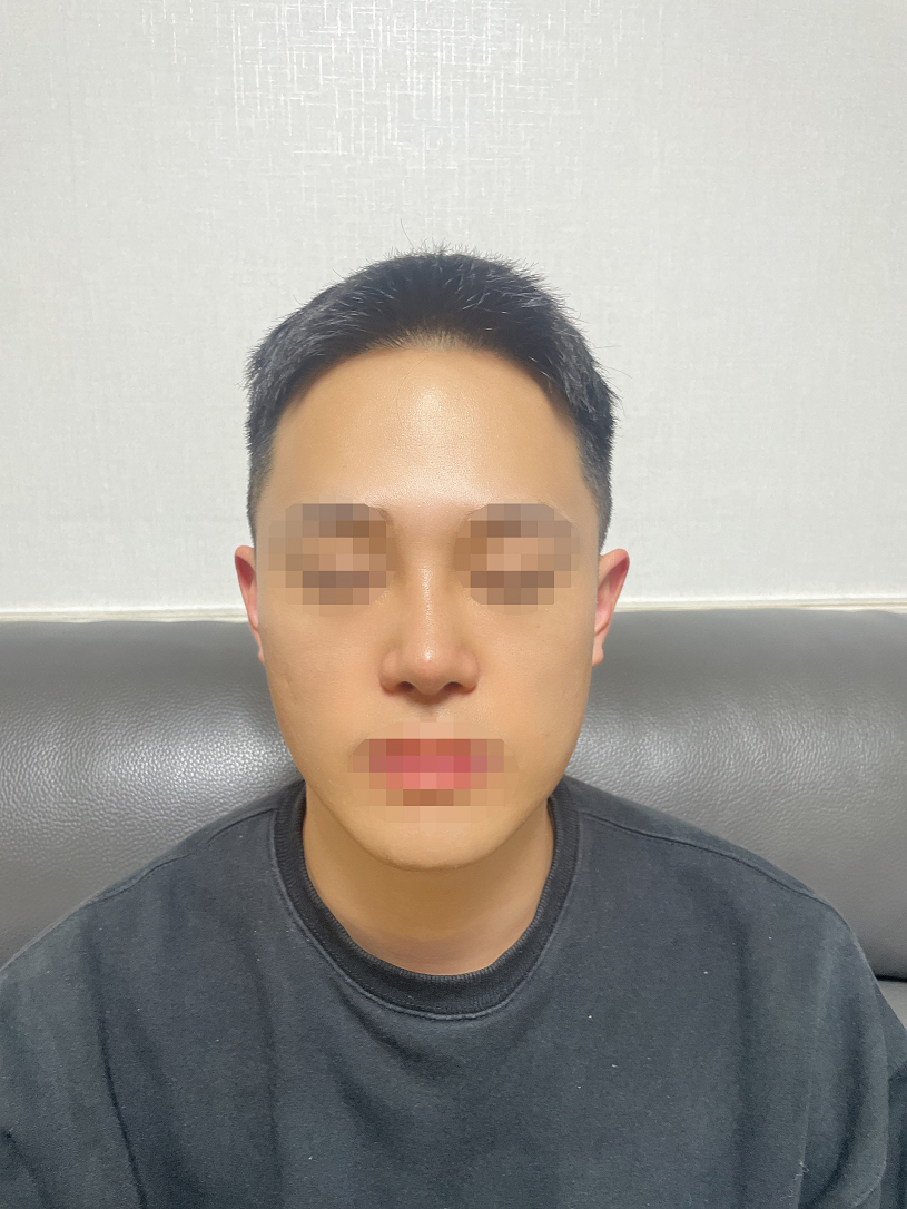 수술후기이미지