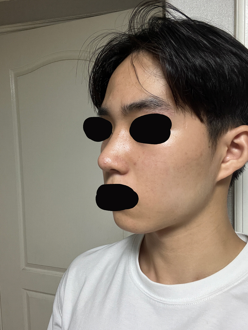 수술후기이미지