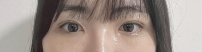 수술후기이미지