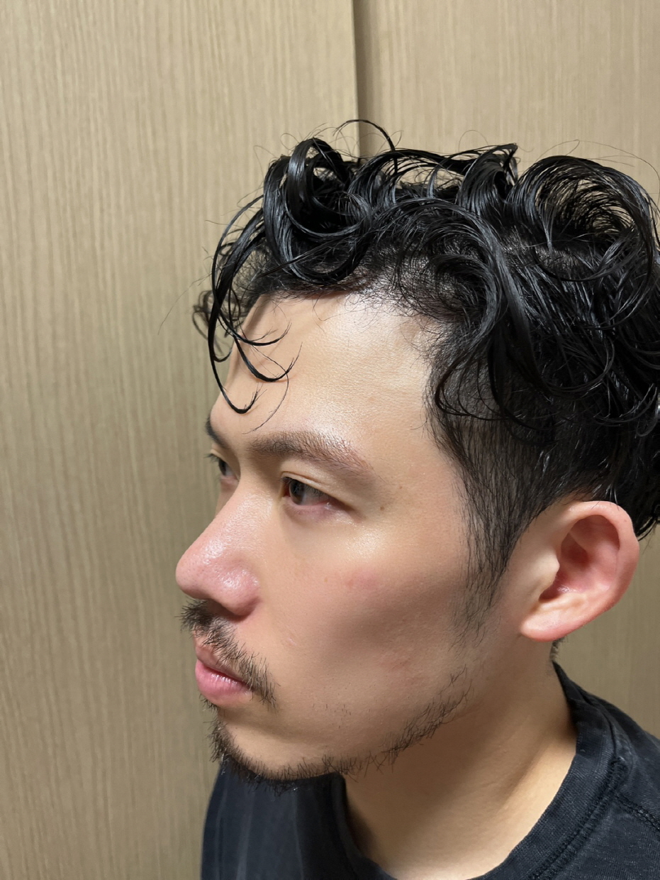 수술후기이미지