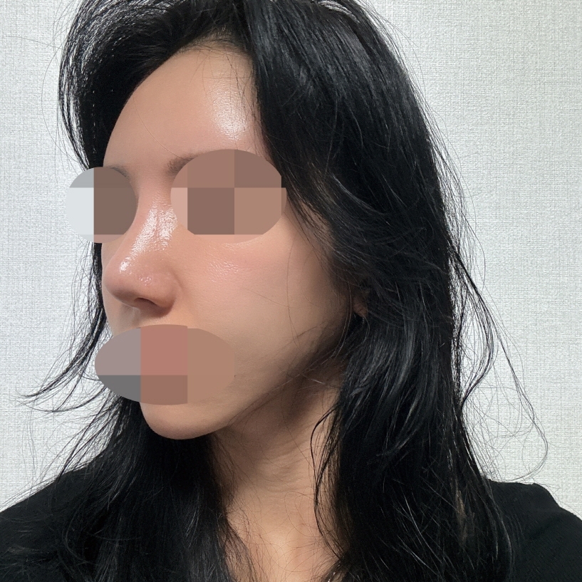 수술후기이미지