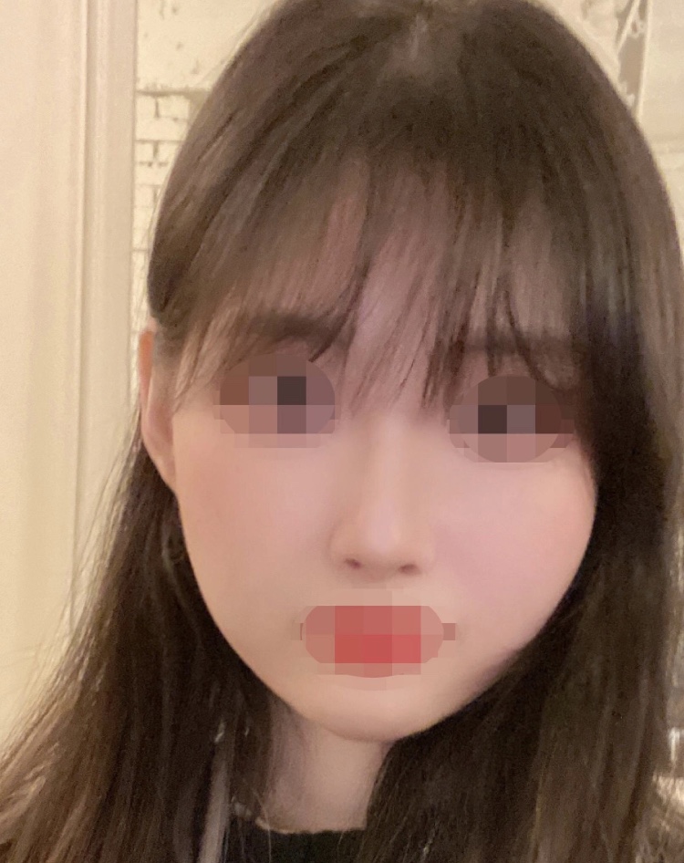 수술후기이미지