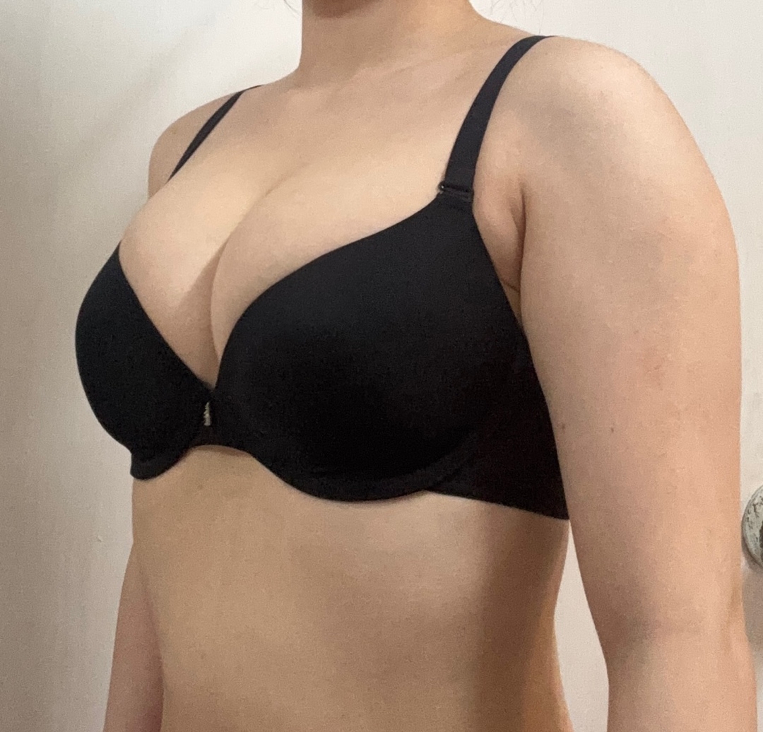 수술후기이미지