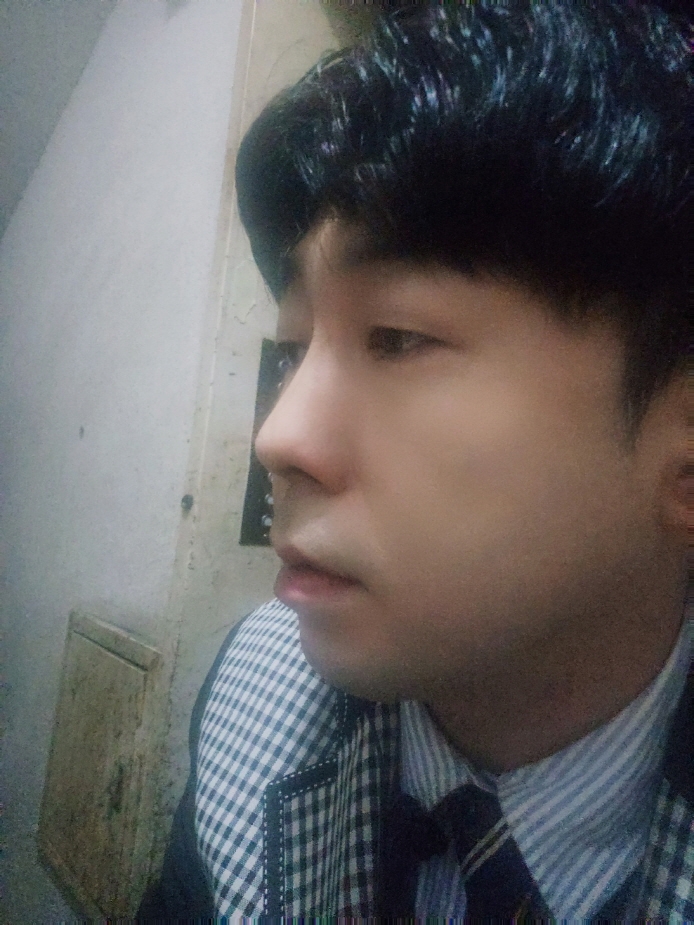 수술후기이미지