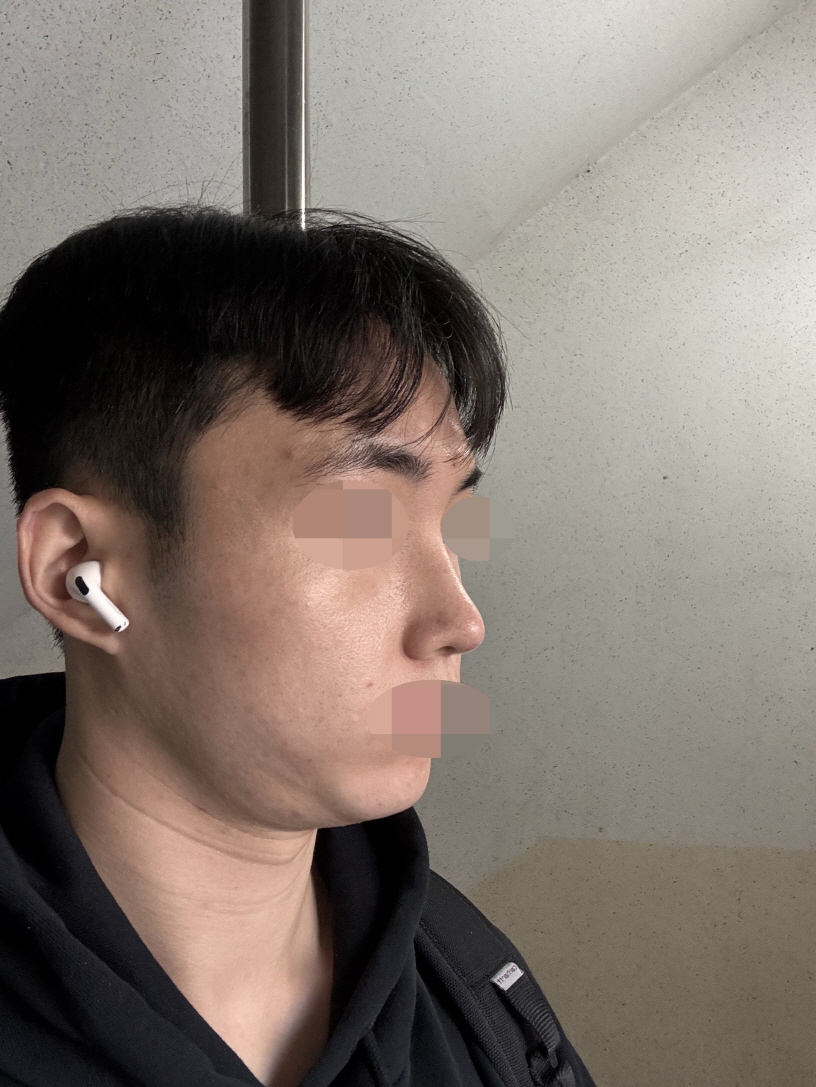 수술후기이미지