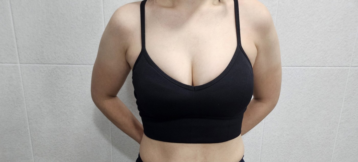 수술후기이미지