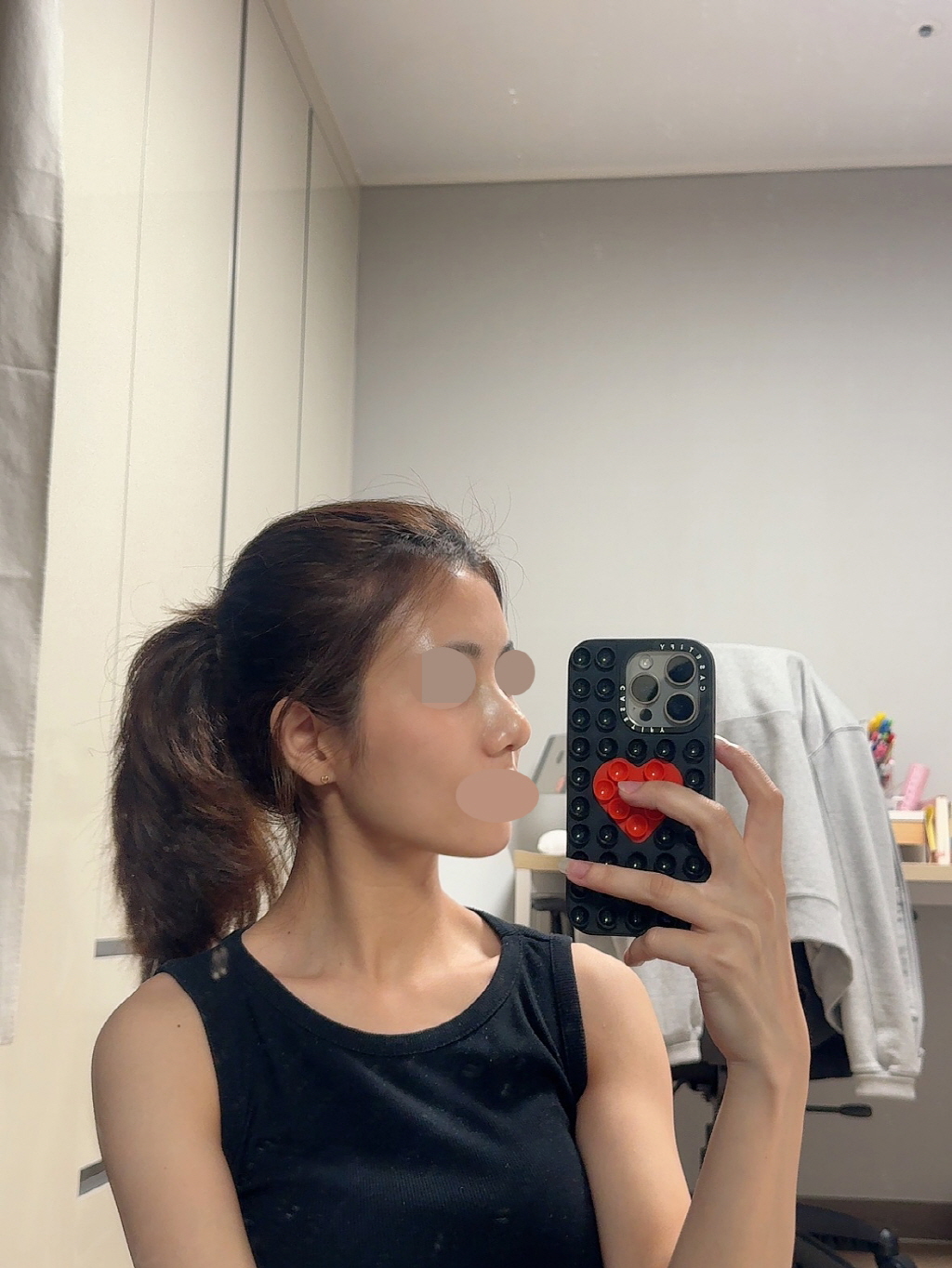 수술후기이미지