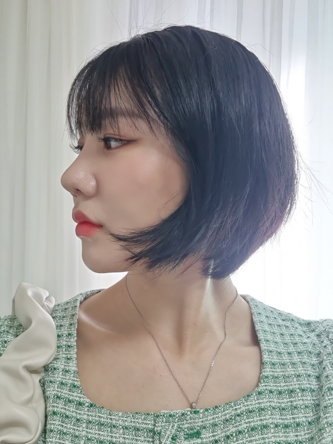 수술후기이미지