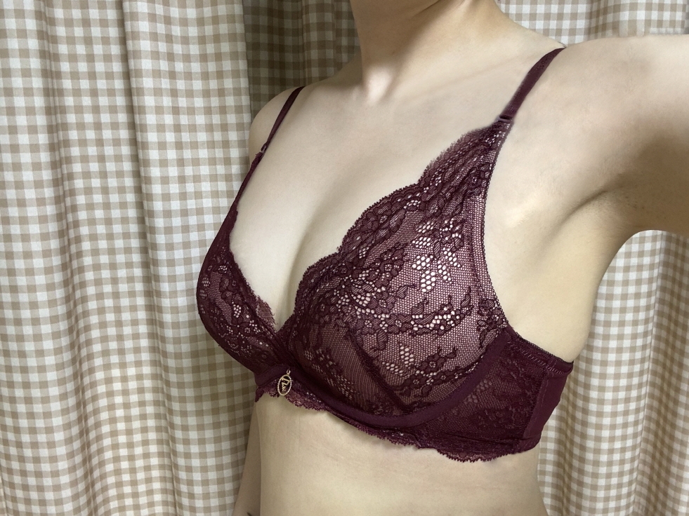 수술후기이미지