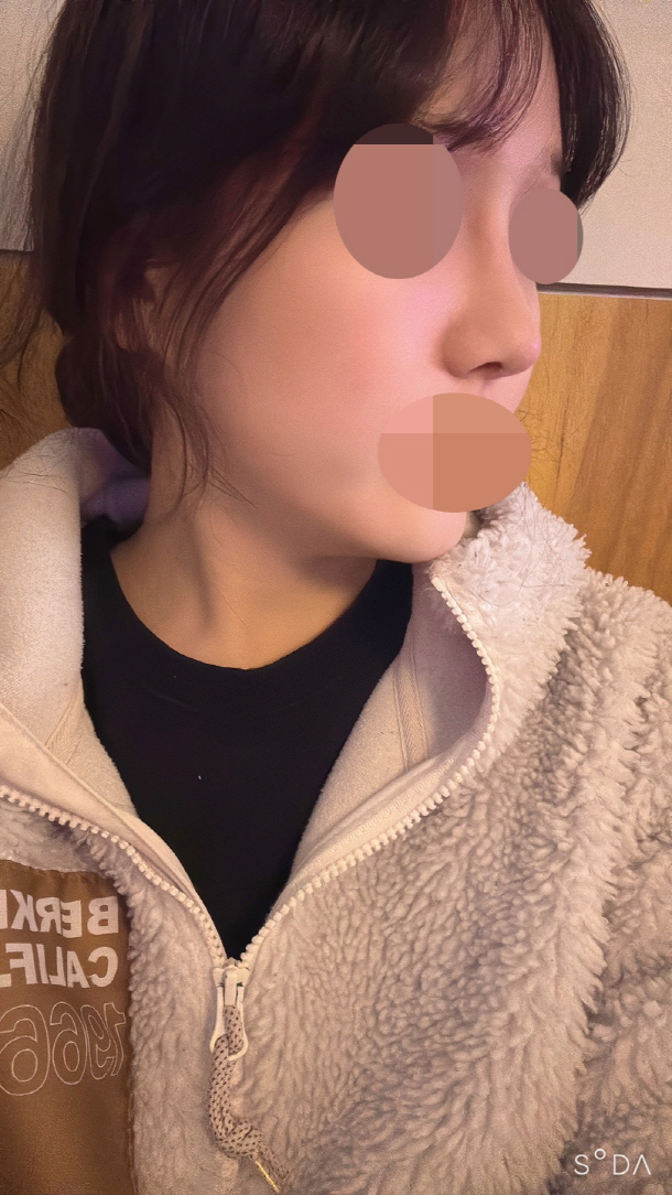 수술후기이미지