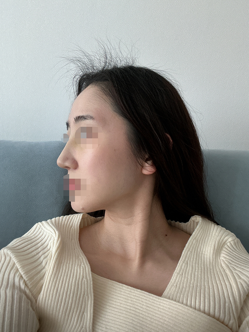 수술후기이미지