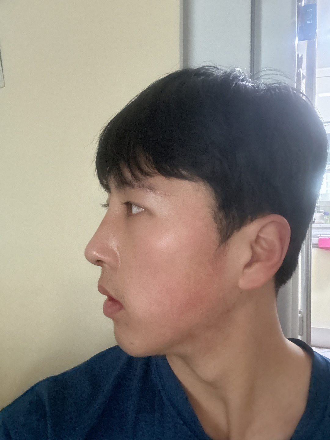 수술후기이미지