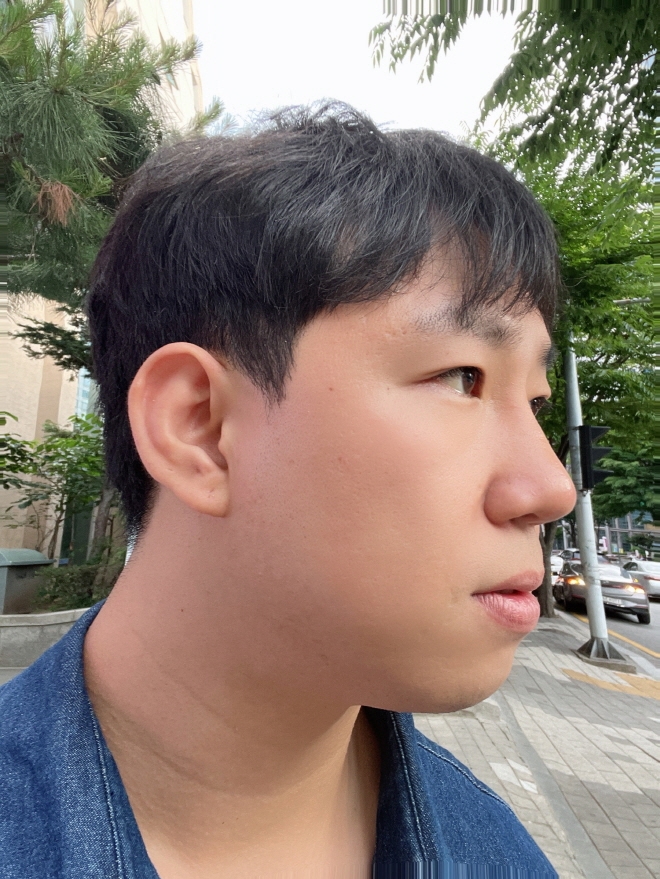 수술후기이미지